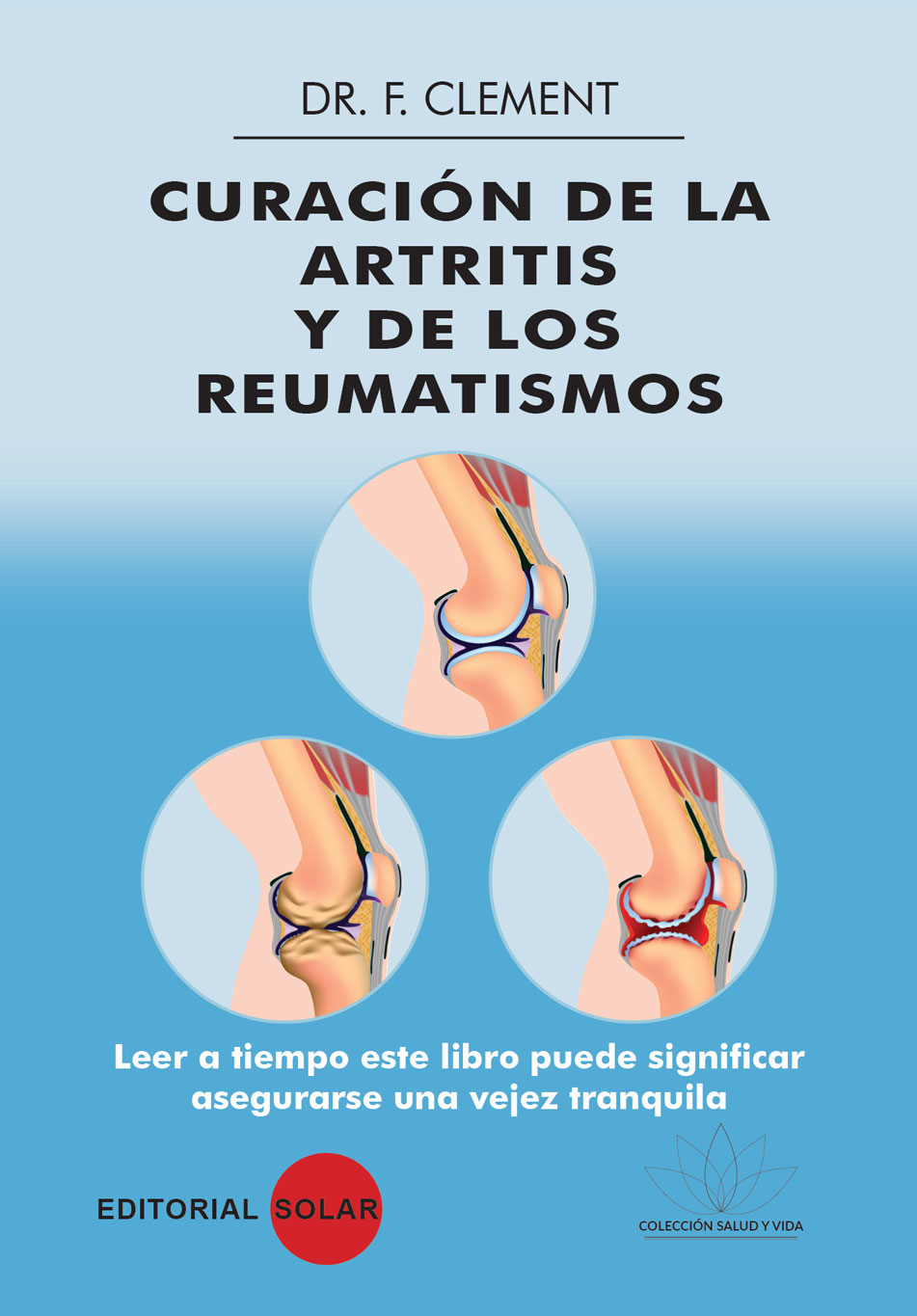 Curación de la artritis y de los reumatismos